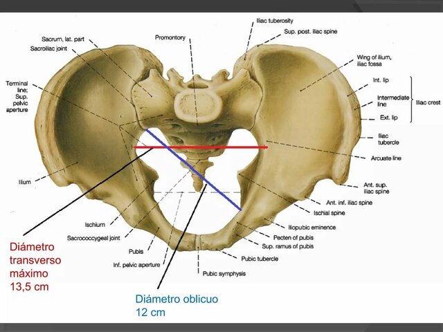 Técnicas para la pelvis