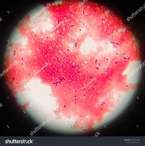 Describe Streptococcus
