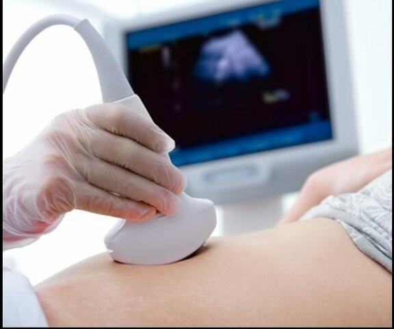 Ecografía