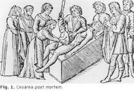 Cesáreas post mortem Egipto.