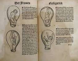 Médico Germano Eucharius Roslin