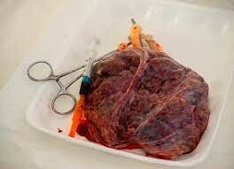 Placenta