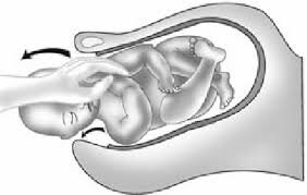 Describió maniobras como.