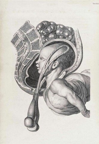 Dublín, Fielding Ould