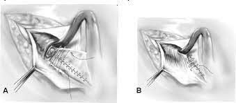 Técnica de ginecología