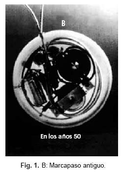 Marcapasos Interno