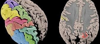 Mediados del siglo XIX.