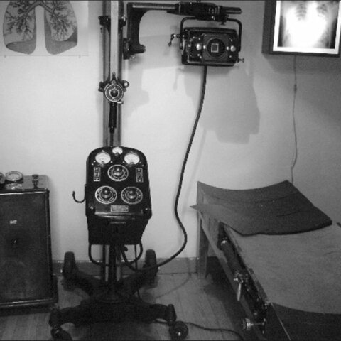 Segundo prototipo de marcapasos.