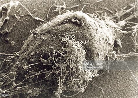 Fotografía a un virus