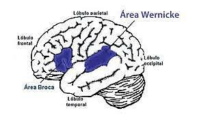 Wernicke-El conectivismo