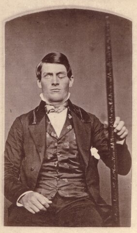 Phineas Gage (1823-1860)