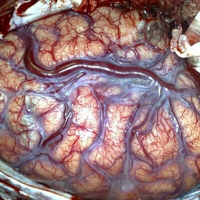 Timeline: Historia de las neurociencias