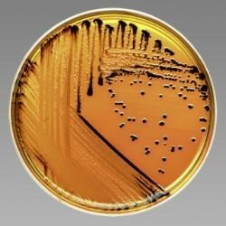 La pasteurización y el control en el laboratiorio