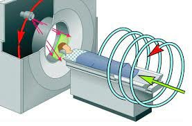 Tomografía helicoidal