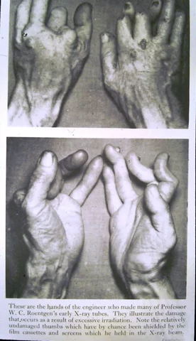 Efectos biológicos de la radiación