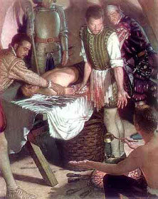 Ambroise Paré, "padre de la cirugía moderna".