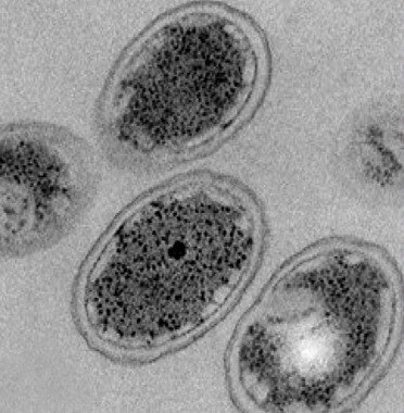 APARICIÓN PRIMERAS CÉLULAS - Hace 3700 Ma