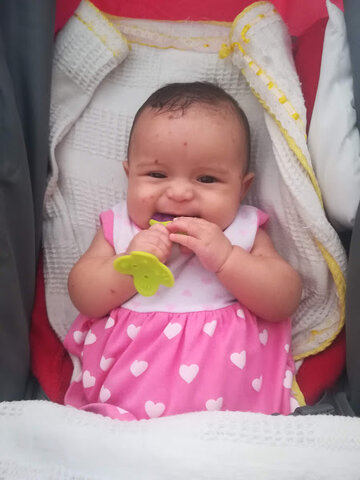 en pandemia me dio Varicela