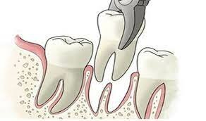 Fue al dentista por un dolor de muela