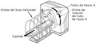 Se desarrolla la TC helicoidal, que permite la adquisición de imágenes en 3D en un solo giro de la máquina.