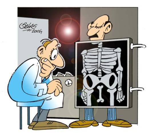 x ray