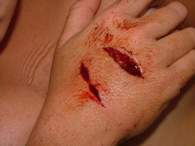 Received his first wound