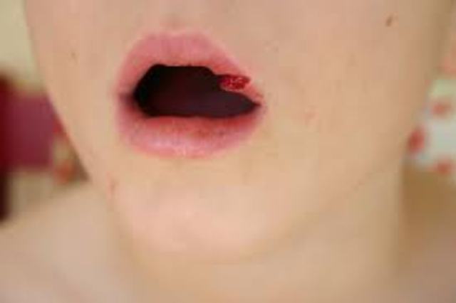 When I busted my face open