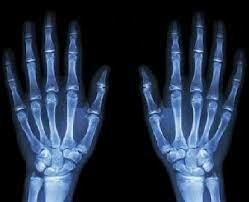 Descubrimiento de los Rayos X