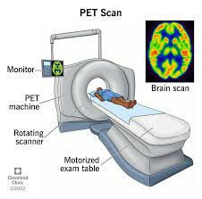 Positron Emission Tomography (PET Scan)