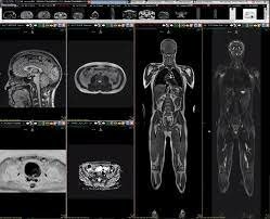 Magnetic Resonance Imaging (MRI)