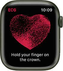 Apple Watch ECGs