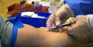 Phlebotomy now