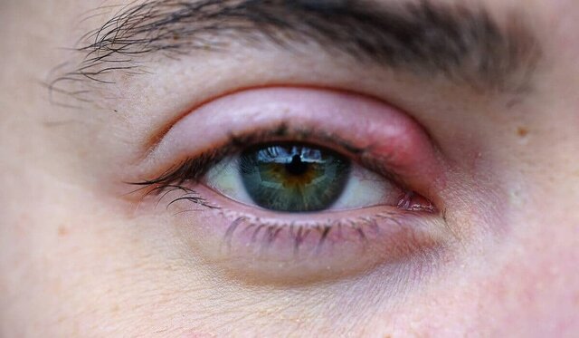 Ingresament a l'hospital