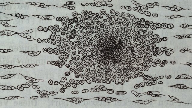 Rudolf Virchow i Robert Remark