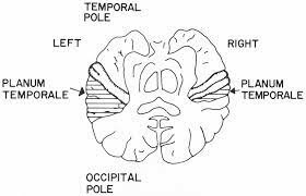 Norman Geschwind y Walter Levitsky (1961)