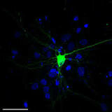 1992-  Green Fluorescent Protein- Marcadores de Proteínas Fluorescentes