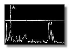 Ian Donald ( A-mode)