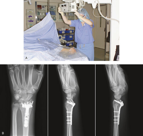 Surgical use of X-rays