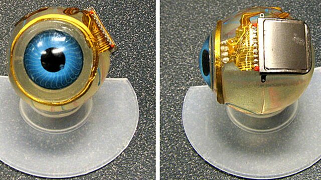 Bionic Eye