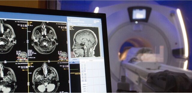 Contribución de los avances