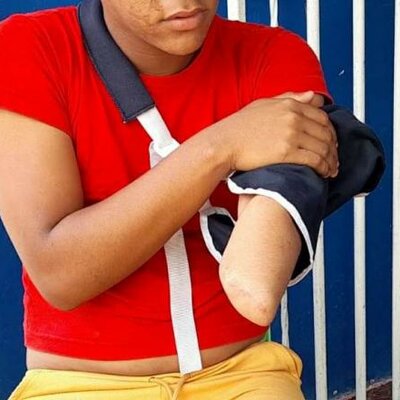 Timeline: La pérdida de un brazo: el costo de ser homosexual