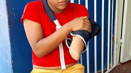 Timeline: La pérdida de un brazo: el costo de ser homosexual