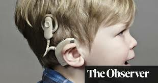 Cochlear Implant