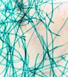 Extincion paleoproterozoico