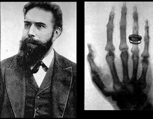 Wilhelm Röntgen discovers X-rays