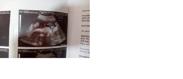 2008-Nacimiento de mi hija