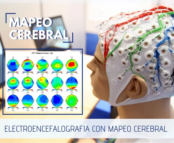Mapeo Cerebral
