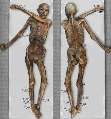 otzi the iceman