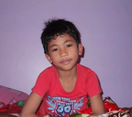 broke brothers thumb