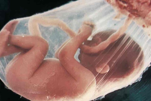 Diagnosere menneskefoster med DNA